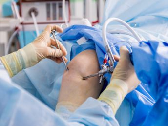 Arthroscopy