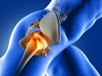 Hip Replacement treatment in Hyderabad