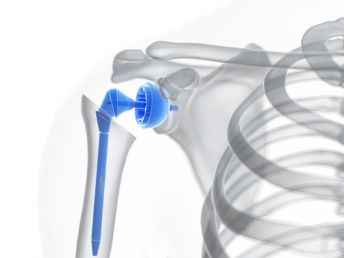 Shoulder Surgery