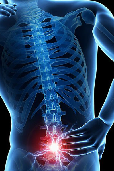 Back Pain-Lumbar Spine Pain